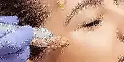 A microneedling facial