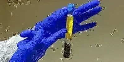 A tube of separated platelet-rich plasma