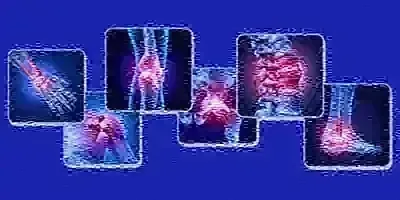 Joints of the wrist, knee, spine and ankle